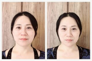 シルキータッチ小顔をお受けくださったお客様